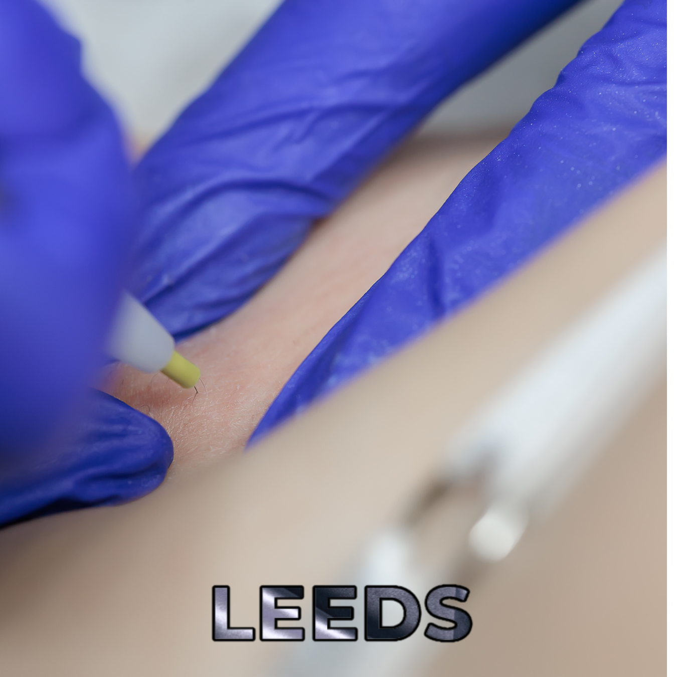 Accredited by ABT ⚡ Advanced Electrolisys (Electrocoagulation) Course – 1 Day Leeds