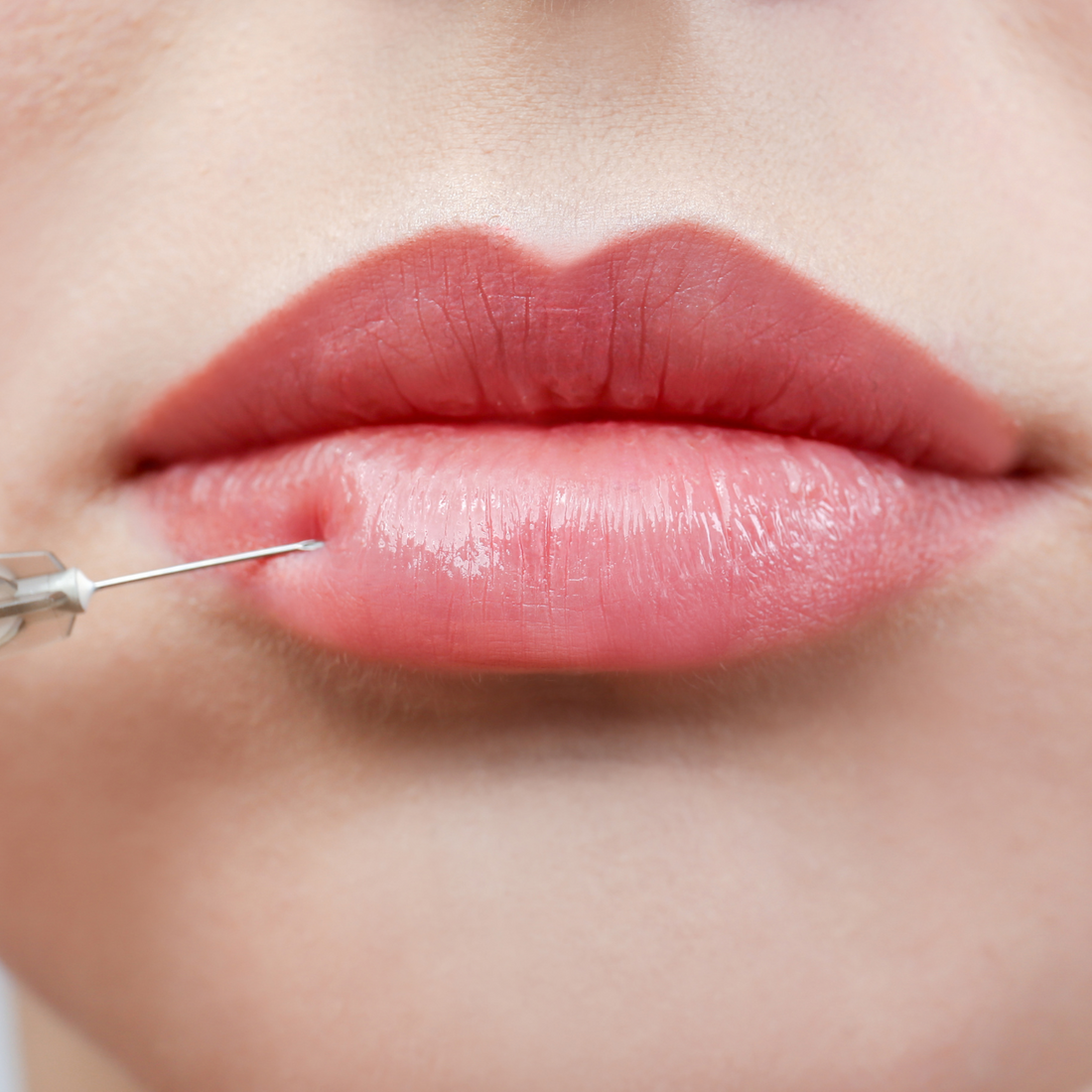 New Licensing Requirements for Non‑Surgical Aesthetic Treatments in England — What You Need to Know