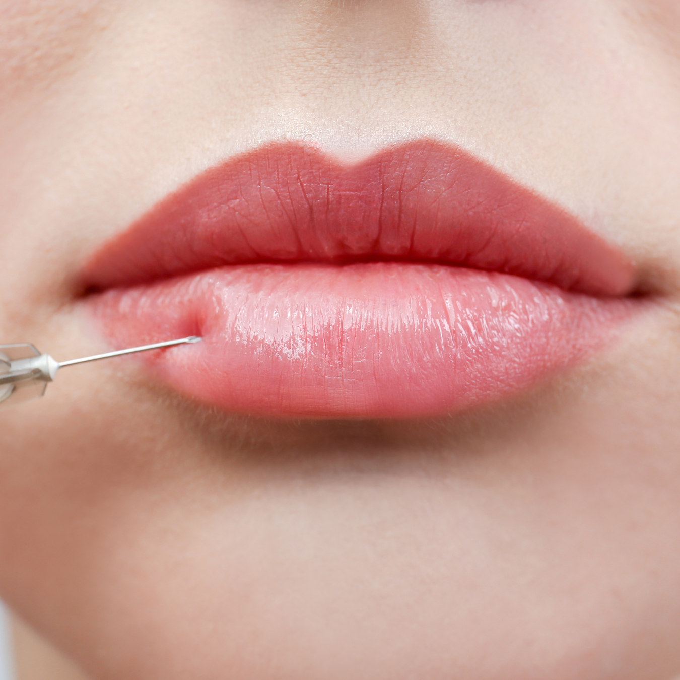 New Licensing Requirements for Non‑Surgical Aesthetic Treatments in England — What You Need to Know