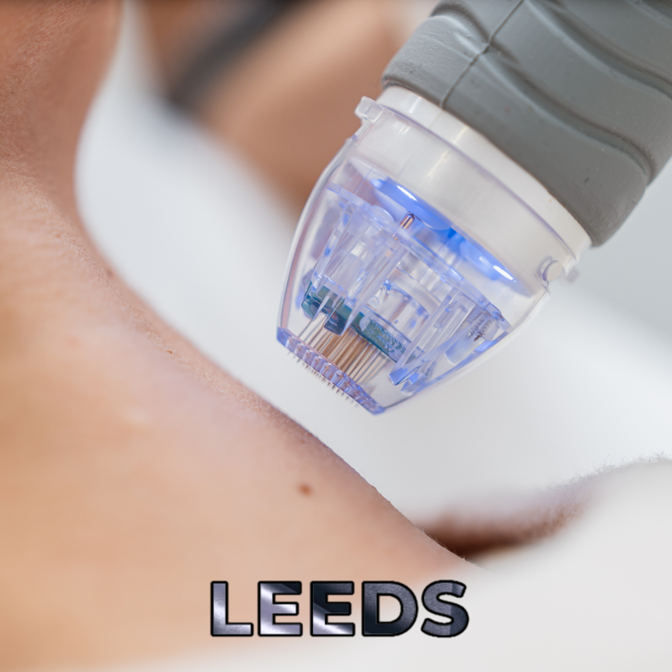 ✨ CPD Group Accredited ✨RF MICRONEEDLING COURSE – FOUNDATION LEVEL (1 DAY) Leeds