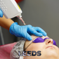 VTCT Skills (ITEC) Level 5 Certificate in Laser Tattoo Removal - Leeds