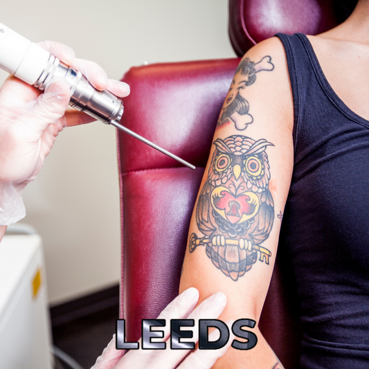 VTCT Skills (ITEC) Level 5 Certificate in Laser Tattoo Removal - Leeds